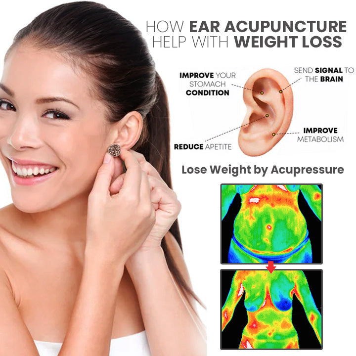 MagneTech Acupuncture Earrings（Limited time discount 🔥 last day）