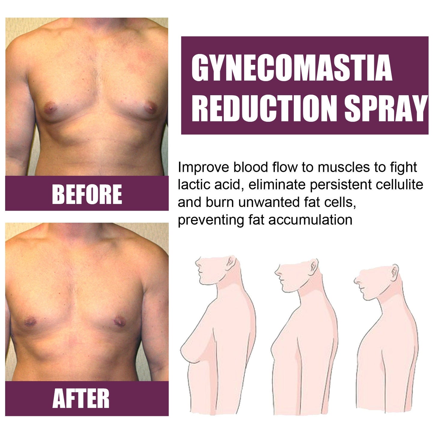 South Moon Gynecomastia Reduction Spray