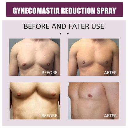 South Moon Gynecomastia Reduction Spray